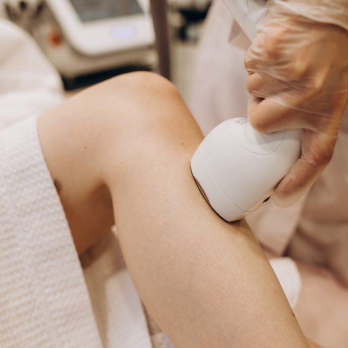 Laser hair removal on legs. Epilation laser. Epilation.